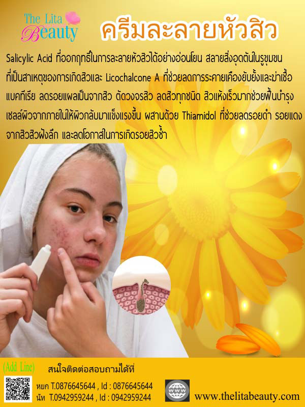 ครีมละลายหัวสิว