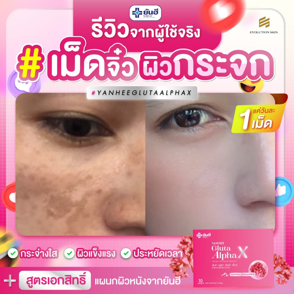 ยันฮี กลูต้า อัลฟ่า เอ็กซ์ สูตรผิวใส ออร่า 3กล่อง