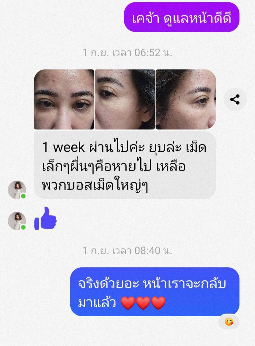 Serum 3 ขวด ชุดผิวเกลี้ยงเนียนละเอียด รูขุมขนเนียนกริ๊บ