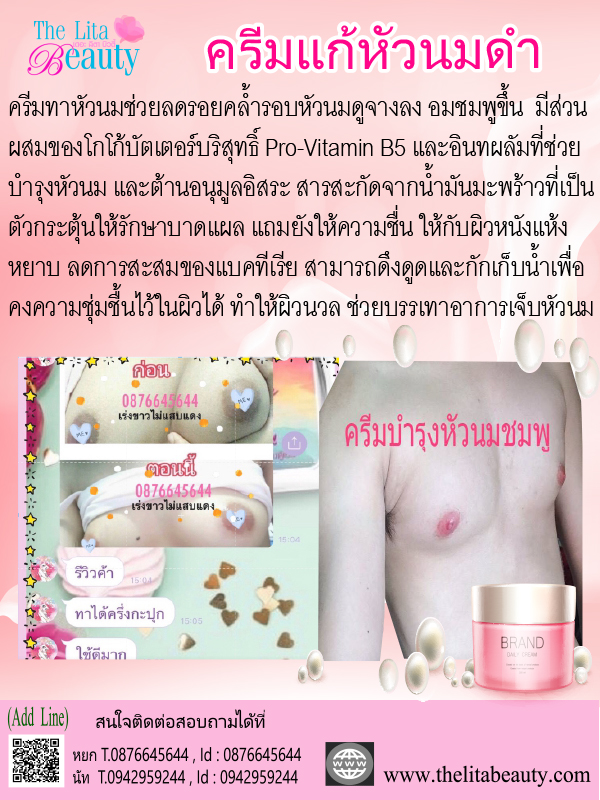 ครีมแก้หัวนมดำ