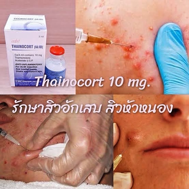 Thainocort10mg 5ml " สิวอักเสบ - สิว บวมแดง "
