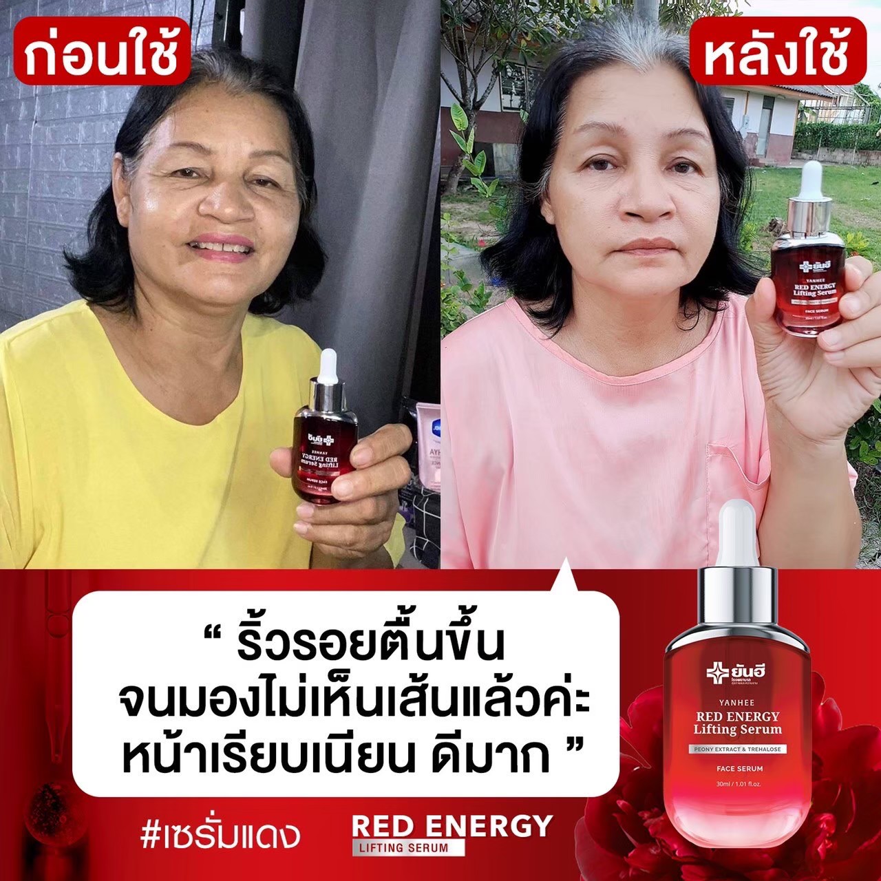Yanhee Red Energy Lifting Serum เซรั่มลดริ้วรอยแห่งวัย 3ขวด