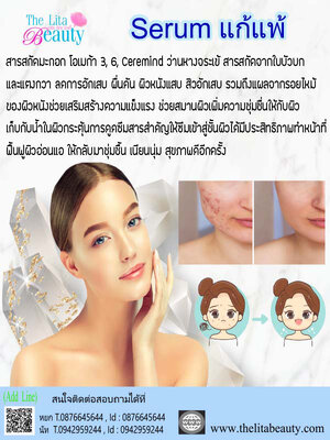 Serum แก้แพ้